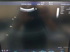超音波診断装置（カラードプラ）｜Vivid S6｜GEヘルスケアの写真11枚目