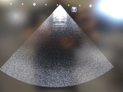 超音波診断装置（カラードプラ）｜Xario100 TUS-X100｜キヤノンメディカルシステムズの写真11枚目