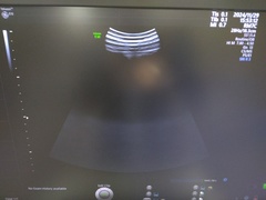 4D超音波診断装置（カラードプラ）｜Voluson E10｜GEヘルスケアの写真11枚目