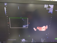 4D超音波診断装置（カラードプラ）｜Voluson E10｜GEヘルスケアの写真11枚目