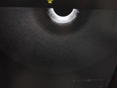 4D超音波診断装置（カラードプラ）｜Voluson P8｜GEヘルスケアの写真11枚目