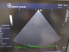 超音波診断装置（カラードプラ）｜LOGIQ P6｜GEヘルスケアの写真11枚目