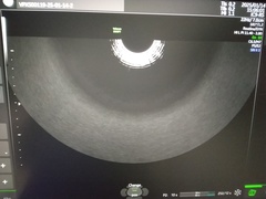 超音波診断装置｜Voluson SWIFT｜GEヘルスケアの写真11枚目