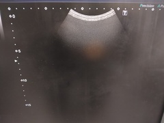 超音波診断装置（カラードプラ）｜Xario100 TUS-X100｜キヤノンメディカルシステムズの写真11枚目