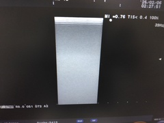 超音波診断装置｜F31｜日立製作所の写真11枚目