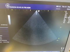 超音波診断装置（カラードプラ）｜LOGIQ P6｜GEヘルスケアの写真11枚目