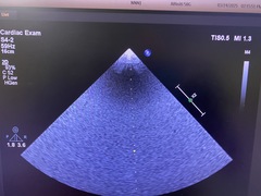 超音波診断装置｜Affiniti 50G｜フィリップスの写真11枚目