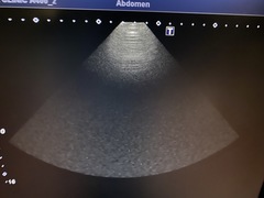 超音波診断装置(カラードプラ)ＬＣＤ｜Aplio 400 TUS-A400｜キヤノンメディカルシステムズの写真11枚目