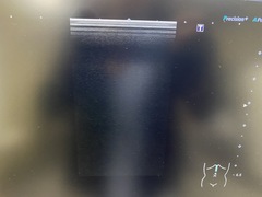 Ultrasound system｜Aplio a CUS−AA000｜Canon Medical Systems photo11