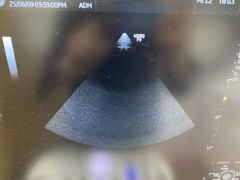 Ultrasound system(Color)｜LOGIQ P9｜GE Healthcare photo11