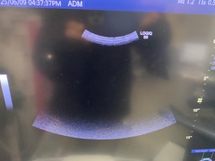 Ultrasound system(Color)｜LOGIQ S8 XDclear｜GE Healthcare photo11