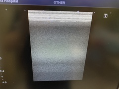 Ultrasound System(Color)｜Xario100 TUS-X100｜Canon Medical Systems photo11