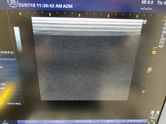 超音波診断装置（カラードプラ）｜LOGIQ P6｜GEヘルスケアの写真11枚目