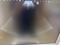 超音波診断装置（カラードプラ）｜XARIO 200 TUS‐X200｜キヤノンメディカルシステムズの写真11枚目