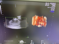 Ultrasound system(Color)｜Voluson E10｜GE Healthcare photo11