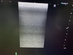 UltrasoundSystem｜Aplio a  Verifia/CUS-AA000｜Canon Medical Systems photo11