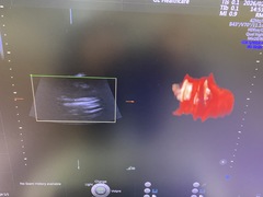 Ultrasound system(Color)｜Voluson E10｜GE Healthcare photo11