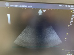 Ultrasound system(Color)｜LOGIQ P9｜GE Healthcare photo11
