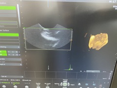 Ultrasound system(Color)｜Voluson P8｜GE Healthcare photo11