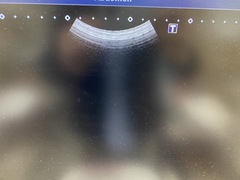 Ultrasound System(Color)｜XARIO 200 TUS‐X200S｜Canon Medical Systems photo11