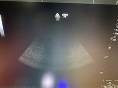 Ultrasound system(Color)｜LOGIQ P9 Pro｜GE Healthcare photo11