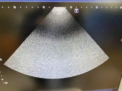 超音波診断装置(カラードプラ)ＬＣＤ｜Aplio 400 TUS-A400｜キヤノンメディカルシステムズの写真11枚目