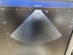 超音波診断装置（カラードプラ）｜XARIO 200 TUS‐X200｜キヤノンメディカルシステムズの写真11枚目