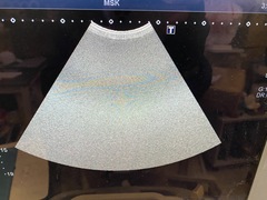 超音波診断装置（カラードプラ）｜Aplio 300｜キヤノンメディカルシステムズの写真11枚目