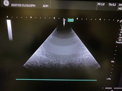 Ultrasound system(Color)｜LOGIQ Fortis｜GE Healthcare photo11