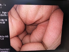 Video Gastroscope｜GIF-Q240｜Olympus Medical Systems photo6