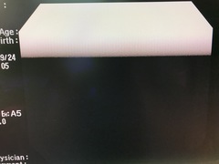 Video Colonoscope｜PCF-Q260AI｜Olympus Medical Systems photo7