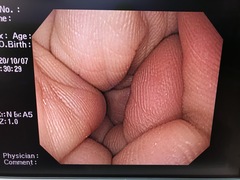 Video Gastroscope｜GIF-PQ260｜Olympus Medical Systems photo8