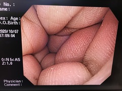 Video Gastroscope｜GIF-Q260｜Olympus Medical Systems photo9