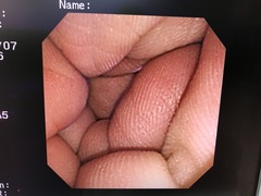 Video Transnasal Gastroscope｜GIF-N260｜Olympus Medical Systems photo8