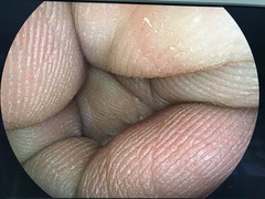 Video Gastroscope｜EG-550WR｜Fujifilm Medical photo12