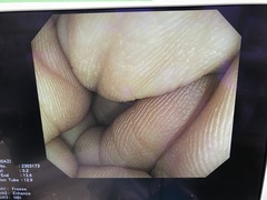 Video Colonoscope｜CF-H260AZI｜Olympus Medical Systems photo11