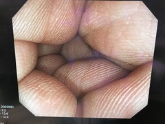 Video Colonoscope｜CF-H260AZI｜Olympus Medical Systems photo8