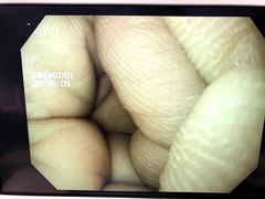Video Gastroscope｜GIF-PV70｜Olympus Medical Systems photo8