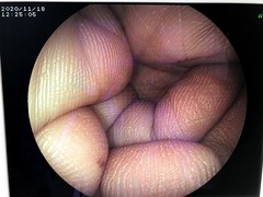Video Colonoscope｜EC-3000MP｜Fujifilm Medical photo7