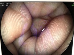 Video Gastroscope｜EG-3000FP｜Fujifilm Medical photo6