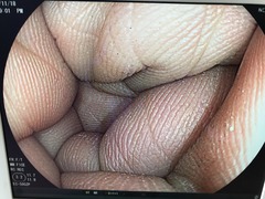 Video Colonoscope｜EC-590ZP｜Fujifilm Medical photo7