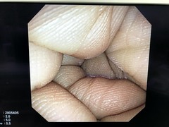 上部消化管汎用ビデオスコープ(径鼻対応)｜GIF-XP260N｜オリンパスメディカルシステムズ株式会社の写真8枚目