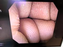 Video Duodenoscope｜JF-260V｜Olympus Medical Systems photo7