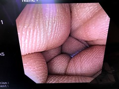 Video Colonoscope｜CF-240I｜Olympus Medical Systems photo6
