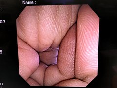 Video Transnasal Gastroscope｜GIF-XP260N｜Olympus Medical Systems photo11