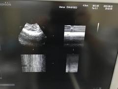 Ultrasound system｜SONOACE R7｜Samsung Medison photo12