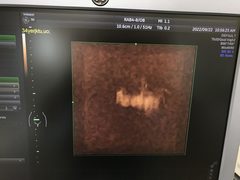 4D超音波診断装置（カラードプラ）｜Voluson S6｜GEヘルスケアの写真12枚目
