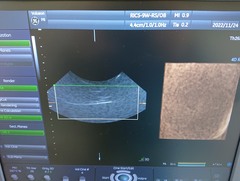 4D超音波診断装置（カラードプラ）｜Voluson P8｜GEヘルスケアの写真12枚目