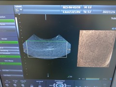 4D超音波診断装置（カラードプラ）｜Voluson P8｜GEヘルスケアの写真12枚目