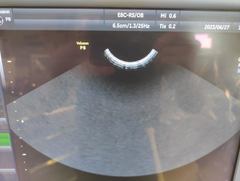 Ultrasound system(Color)｜Voluson P8｜GE Healthcare photo12
